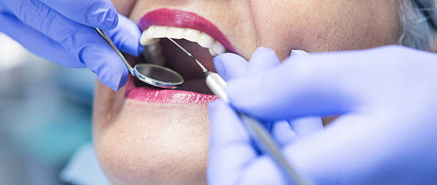 Best Dental Abscess Treatment in Crosby, MN