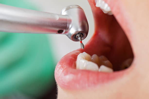 Best Emergency Denture Repair in Crosby, MN